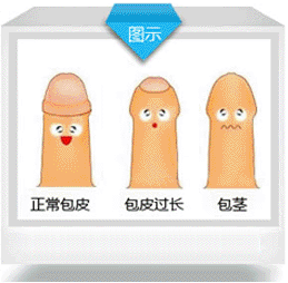 ��Ƥ�೤��Ҫ��?����Ҫ���Ƥ��?